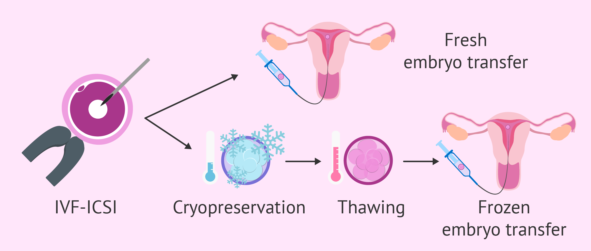 Achieve Parenthood with Frozen Embryo Transfer | Advance Fertility & Gynecology Centre