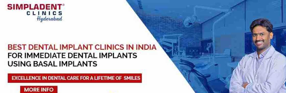 Best Dental Implant Clinic in Hyderabad