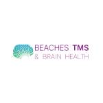 Beaches TMS Brain Health