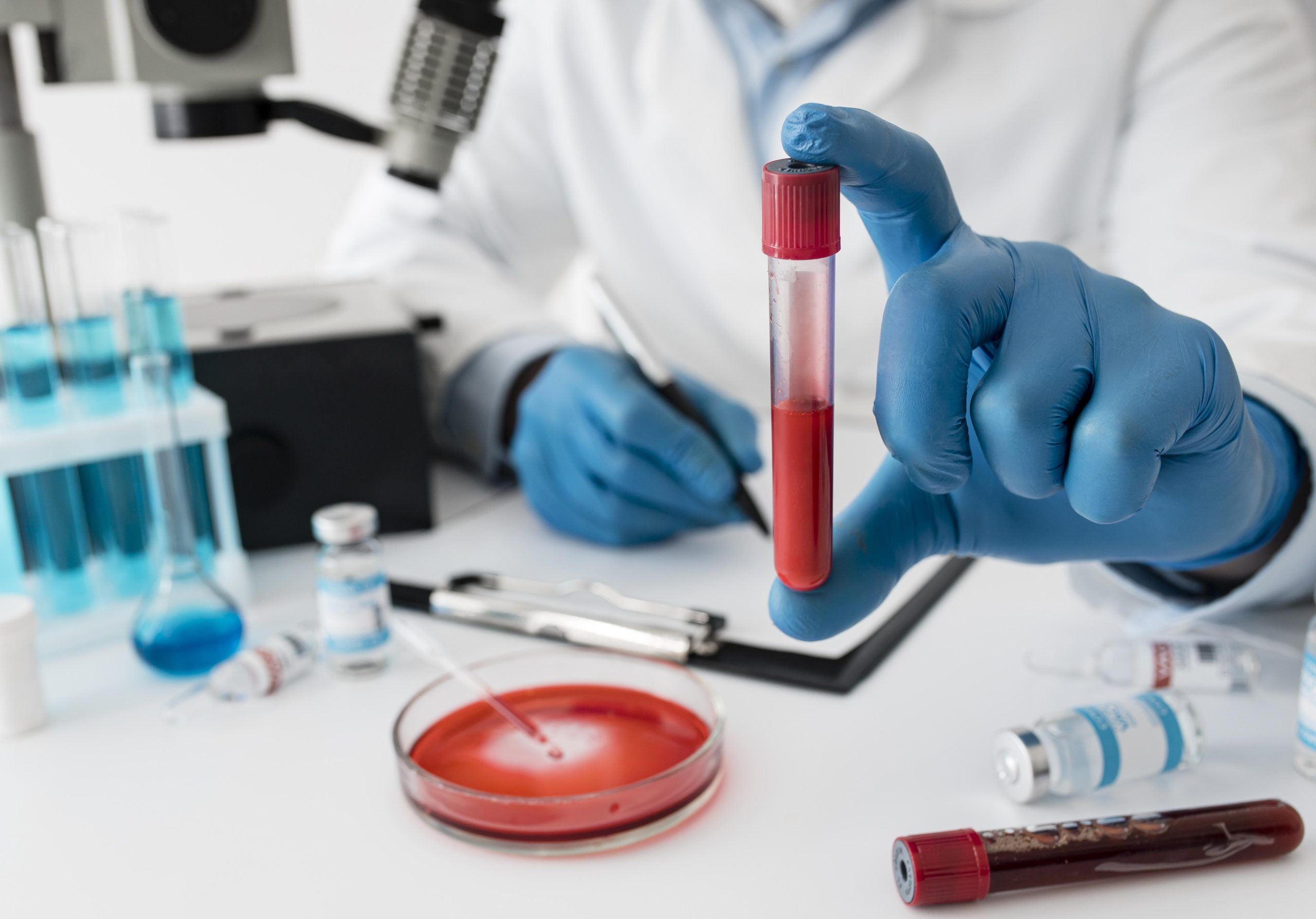 Convenient, Accurate, and Hassle-Free Diagnostics: A Complete Guide to Home Blood Testing in Bengaluru