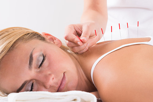 acupuncturetips