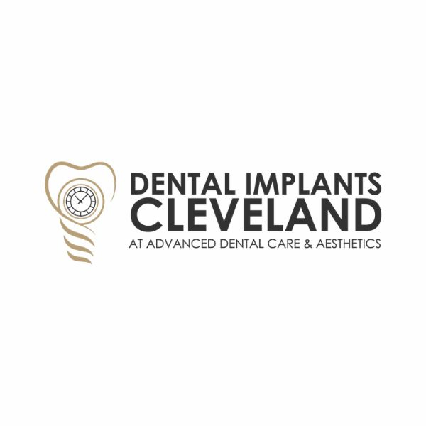 dental_implants