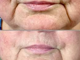 aliaestheticsmd